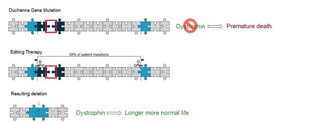 MyoDys45-55